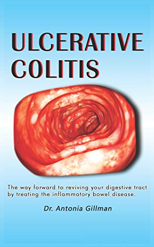 ULCERATlVE COLlTlS: |A way forward to reviving your digestive tract by treating the inflammatory bowel disease