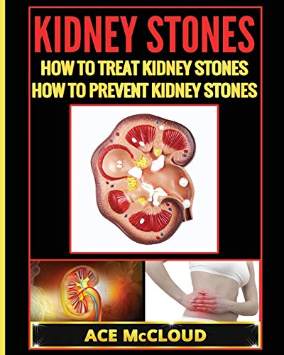 Kidney Stones: How To Treat Kidney Stones: How To Prevent Kidney Stones (Kidney Stone Treatment & Prevention Guide with All)