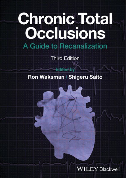 Chronic Total Occlusions: A Guide To Recanalization