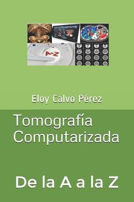 Tomografía Computarizada: De La A A La Z (Spanish Edition)