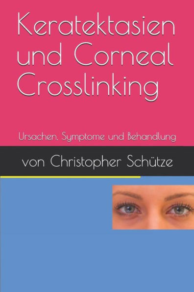 Keratektasien, Corneal Crosslinking: Ursachen, Symptome und Behandlung (German Edition)