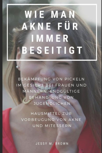 Wie Man Akne Für Immer Beseitigt: Bekämpfung Von Pickeln Im Gesicht Bei Frauen Und Männern, Endgültige Behandlung Von Jugendlichen Hausmittel Zur Vorb